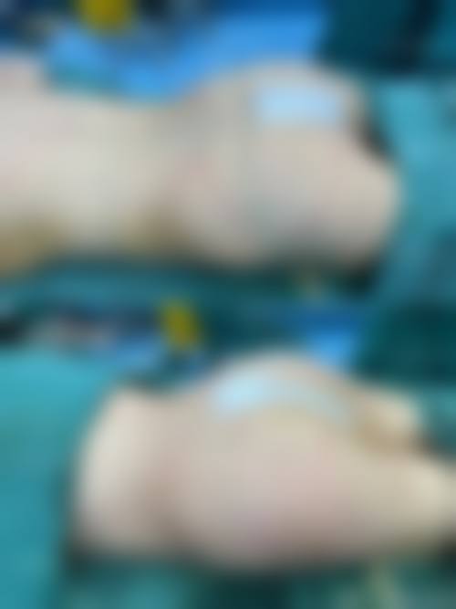 临床实例分享：深圳尚虹医疗美容门诊部卫咏军