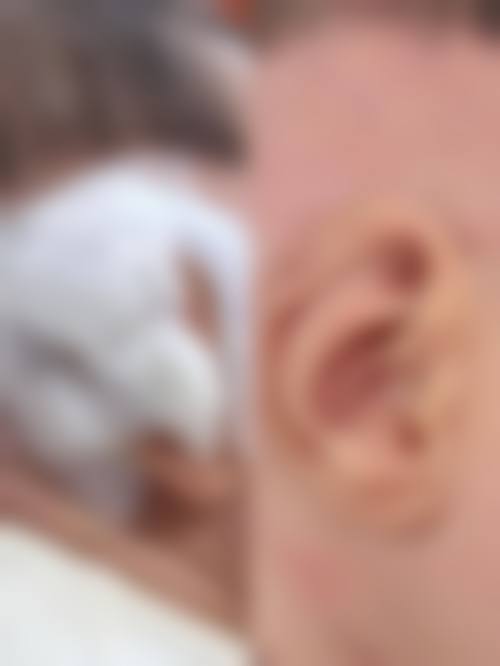 临床实例分享