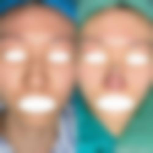 擅长项目详解