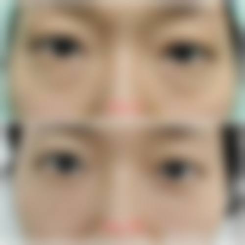 高端医疗设备与特色项目打造出色医美体验