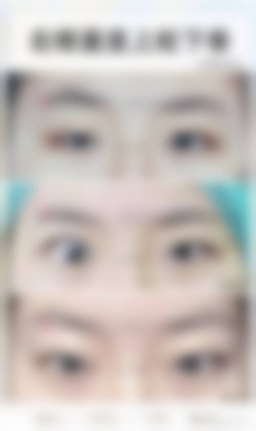 诊疗特色总结:高敏医生的技术有何独特之处