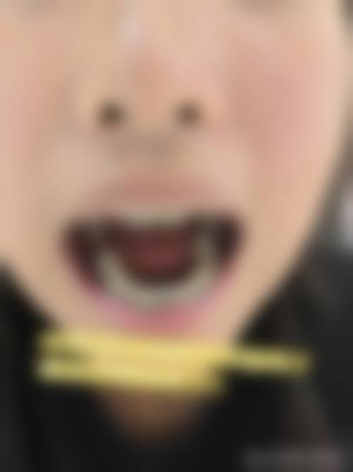 临床实例分享