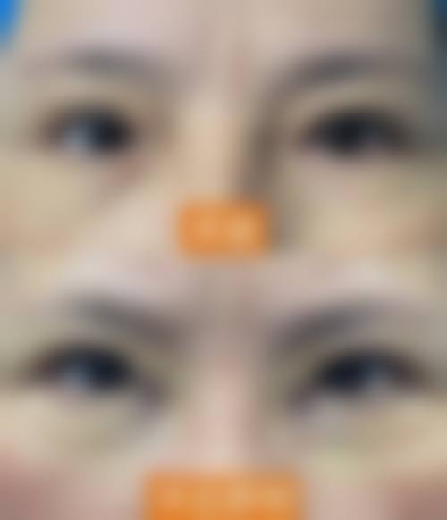 预约优惠活动河北北方学院附属第二医院眼科李亚坤