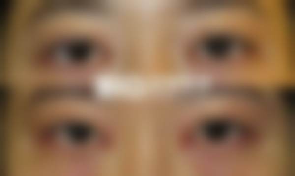 患者真实评价