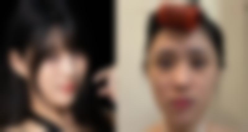 【广州美后整形医院特色项目:】