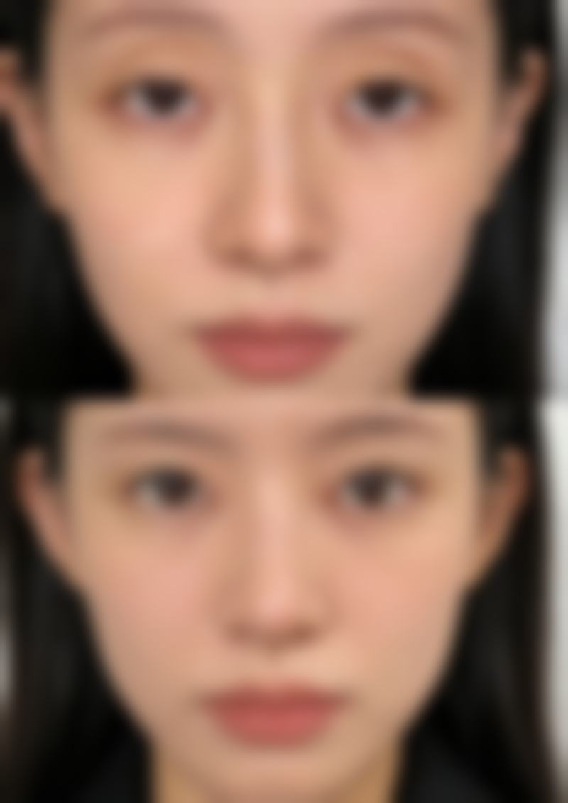 【广州美后整形医院医生团队:】