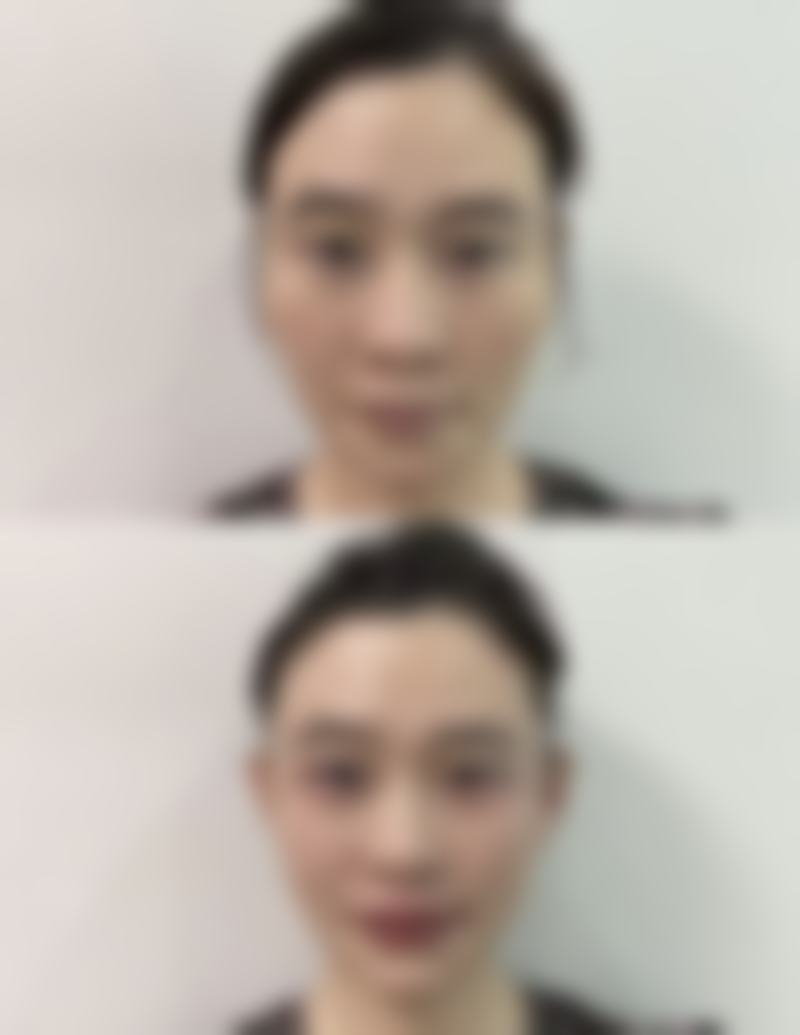 【南京羽兮医疗美容诊所患者口碑评价：】