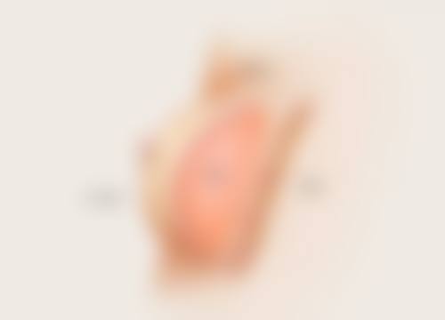 种植头发要多少钱具体怎么收费