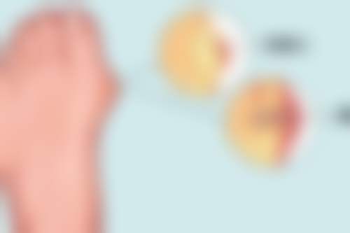 擅长项目详解:孙超锋医生核心技术与适应症