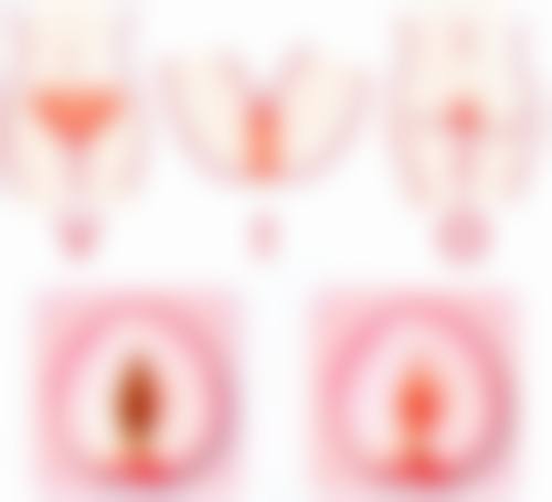 【无锡雍禾医疗美容门诊部是正规的吗?】