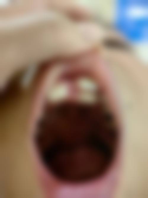 常见问题解答