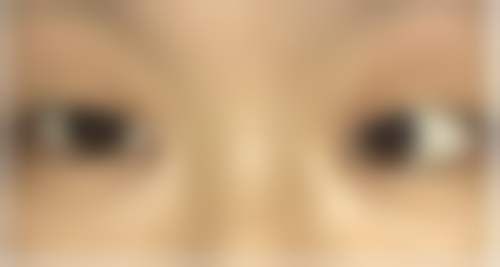 结尾预约号召:立即行动,重获清晰视界