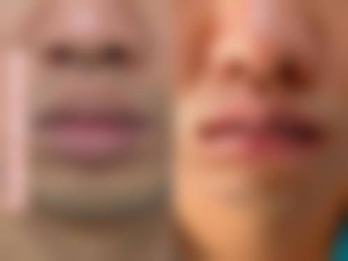临床实例分享:治疗成效真实可靠吗?