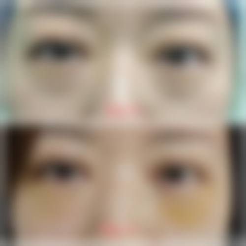 预约优惠活动