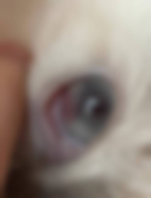临床实例分享