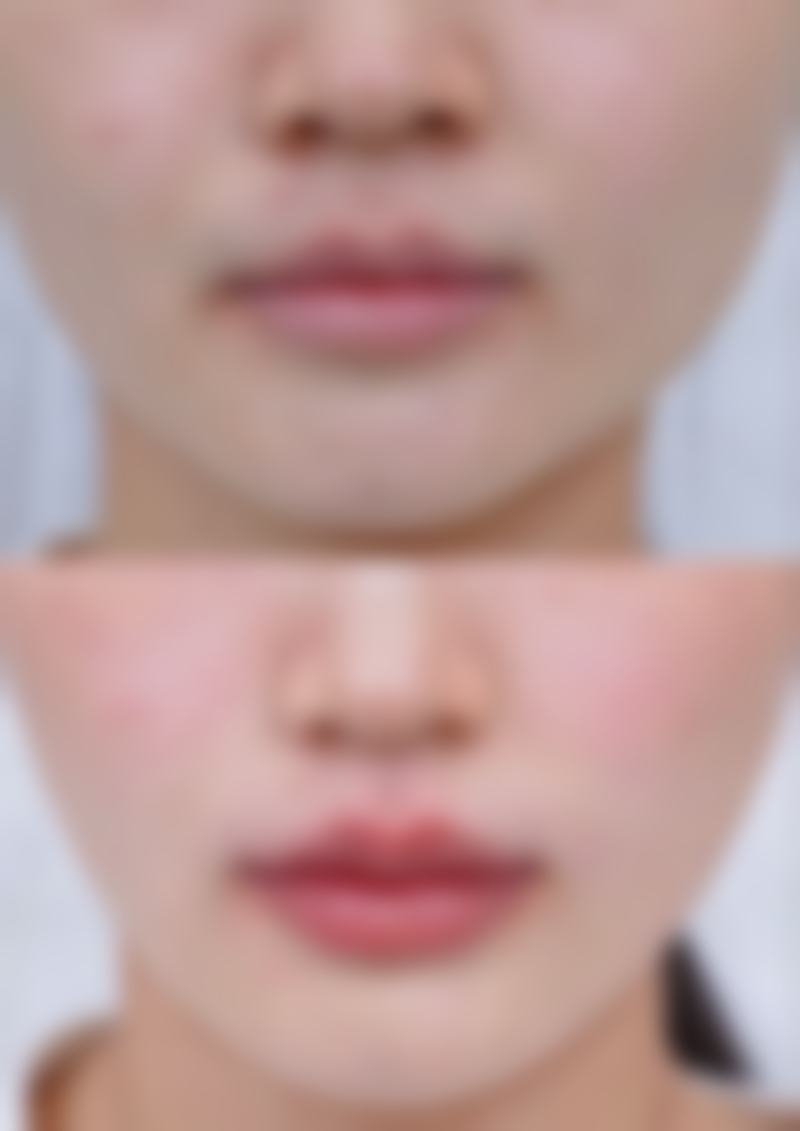 患者真实评价
