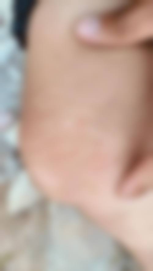 患者真实评价:周晶蓉医生的口碑见证