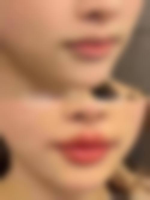 擅长项目详解:周晶蓉医生的核心技术