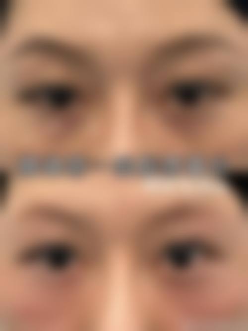 临床实例分享:周晶蓉医生的真实反馈