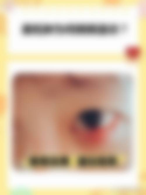 特色项目覆盖与全生命周期护眼