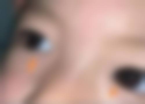 临床实例分享