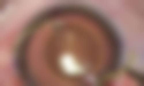 诊疗特色总结：细致入微的人文关怀