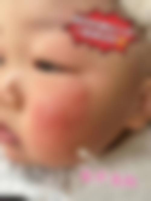 擅长项目详解:精细匹配各类眼疾需求