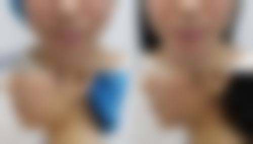 热门项目价格参考