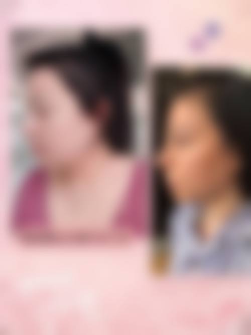 总结与预约指引：开启美丽新篇章
