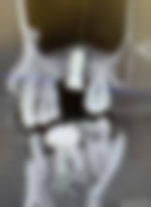 总结与预约号召
