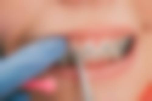 透明收费体系与优惠活动详情