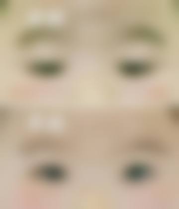 临床实例分享:真实反馈见证疗效