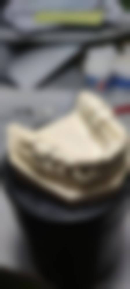 价格透明与优惠活动详情