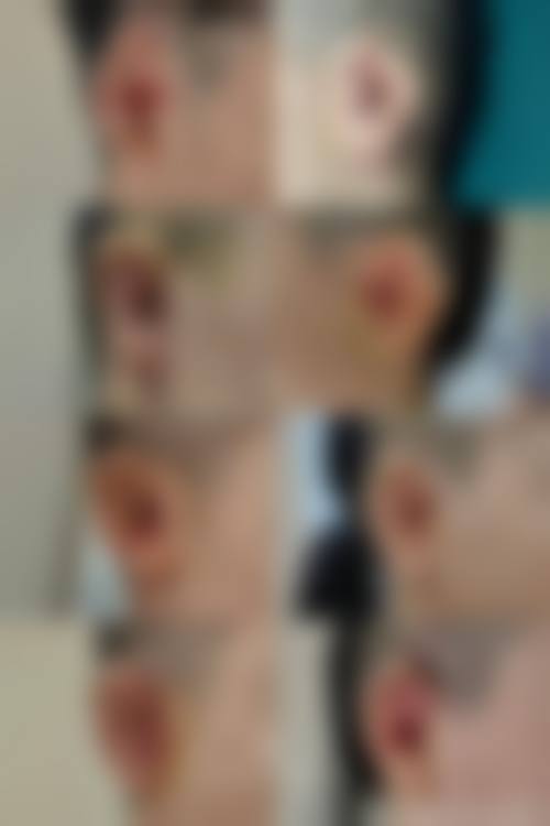 患者真实评价:口碑如何?