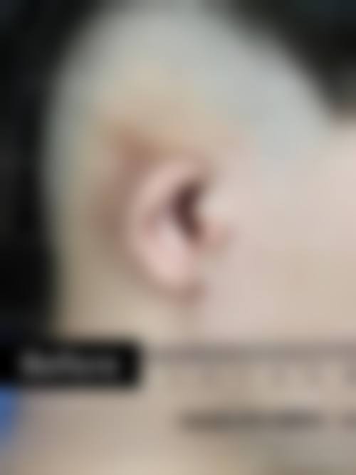 预约优惠活动:韩志强医生有什么优惠?