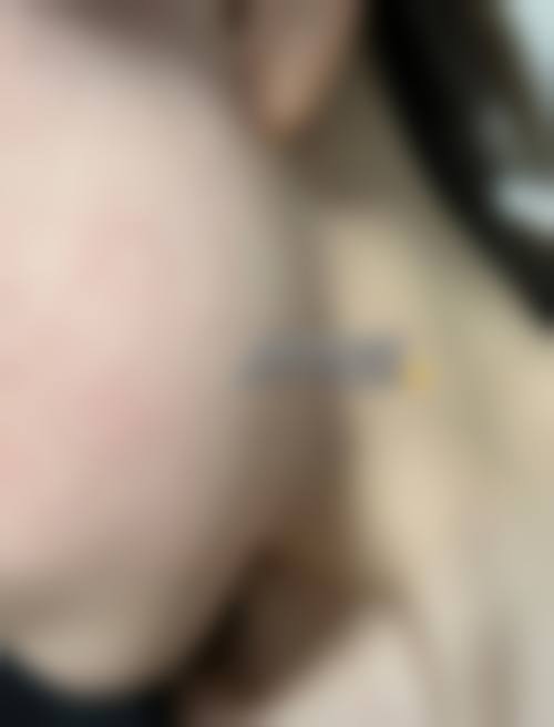 临床实例分享:真实反馈与成效