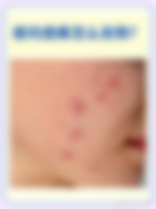 诊疗特色总结:为什么选择韩志强医生?