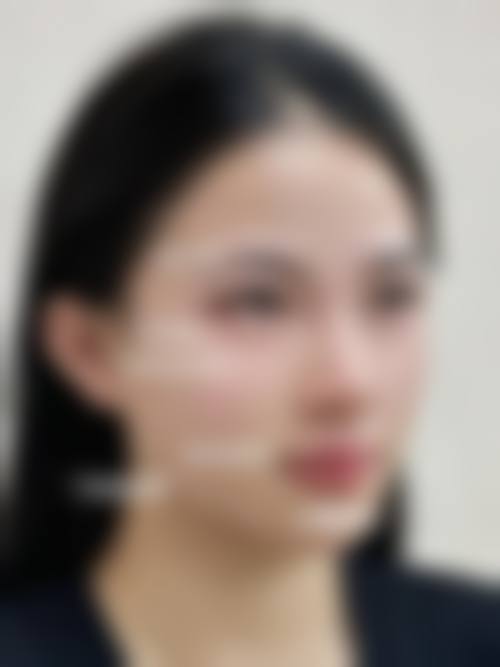 高端医疗设备与特色整形项目解析