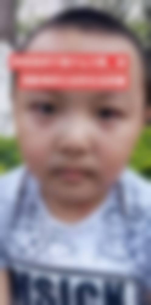 临床实例分享：真实疗效见证专精实力