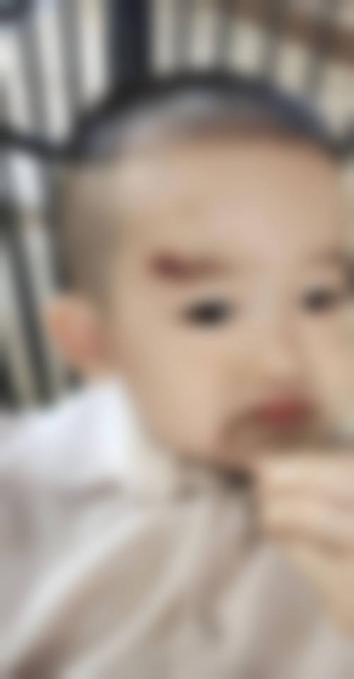 患者真实评价:口碑积累源于用心服务