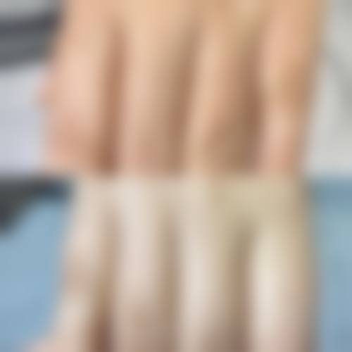 核心技术优势：PSE微针与分层剃发打造无痕美学