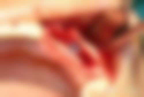 数字化医疗设备与无菌环境:精细诊疗的技术基石