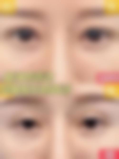 临床实例分享:真实反馈见证疗效