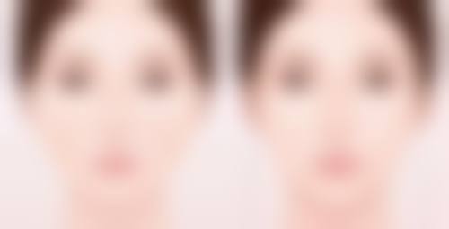 打了瘦脸针术后其他注意事项汇总