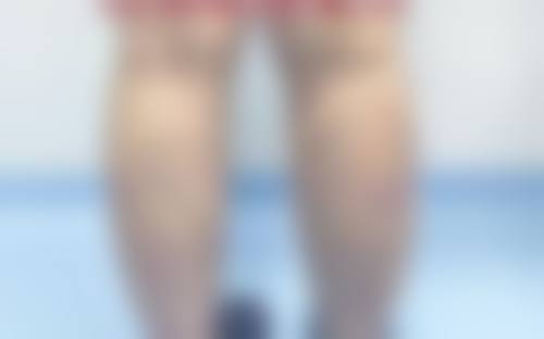 患者真实评价