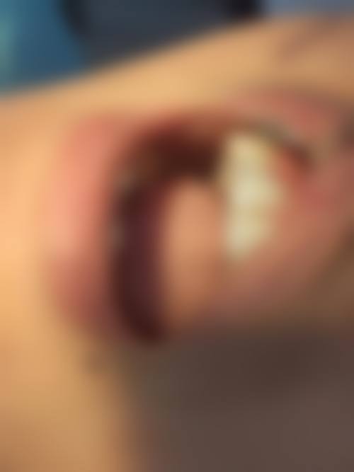 热门口腔项目介绍与市场价参考