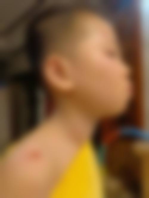 临床实例分享