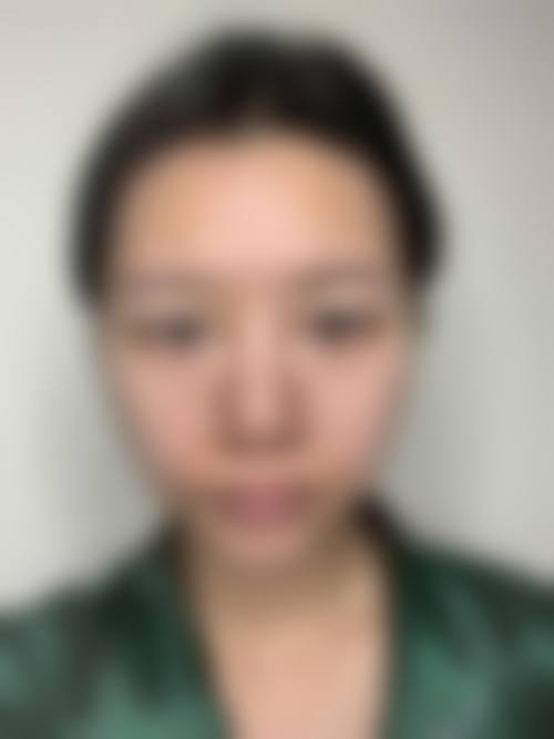患者真实评价