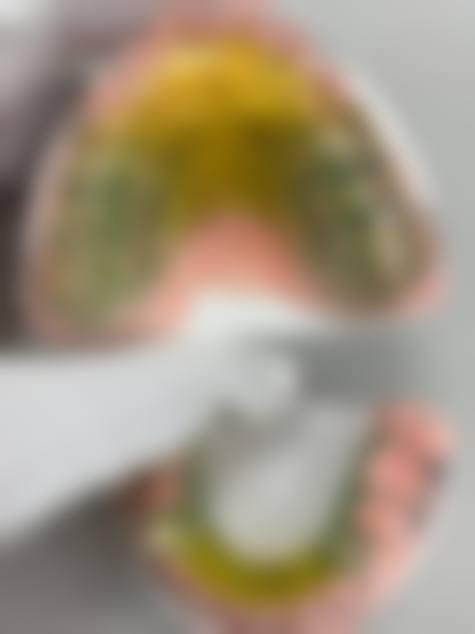 临床实例分享