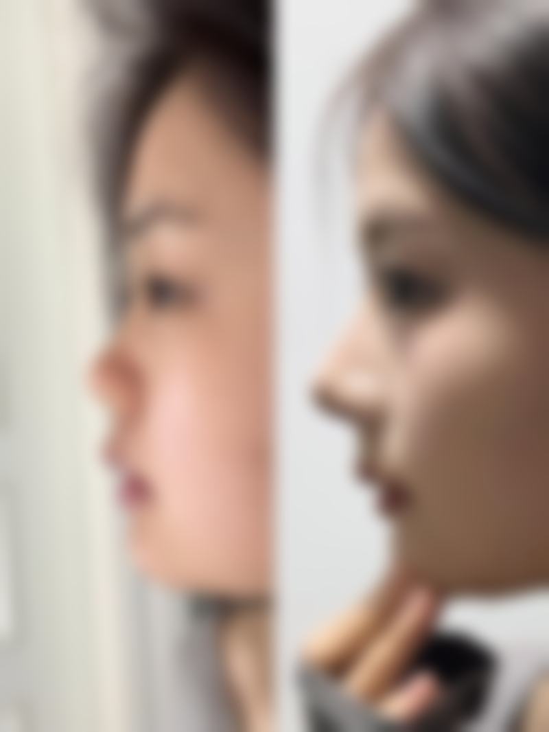 盘锦妇外医院微整形科是正规的吗?